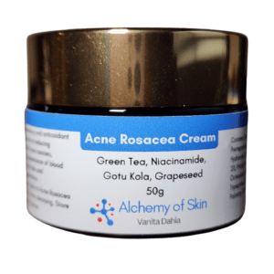 Acne Rosacea Cream 50g
